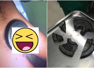 Pasiune dusă la extrem! A durat 3 ore ca pompierii să-i poată scoate greutățile de pe „bară” Pasiune dusă la extrem! A durat 3 ore ca pompierii să-i poată scoate greutățile de pe "bară"