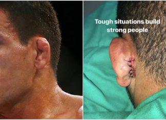 Un luptător UFC a trebuit să-și coase urechea la loc după luptă Un luptător UFC a trebuit să-și coase urechea la loc după luptă