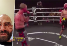 Vezi cum arată Artem Lobov, prietenul lui McGregor și adversarul său după o luptă de box fără mănuși! (VIDEO) Vezi cum arată Artem Lobov, prietenul lui McGregor și adversarul său după o luptă de box fără mănuși! (VIDEO)