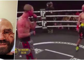 Vezi cum arată Artem Lobov, prietenul lui McGregor și adversarul său după o luptă de box fără mănuși! (VIDEO) Vezi cum arată Artem Lobov, prietenul lui McGregor și adversarul său după o luptă de box fără mănuși! (VIDEO)