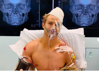 Unui fost luptător din UFC i-au fost scoase 30 de bucăți de os din față după ce și-a luat KO! (VIDEO) Unui fost luptător din UFC i-au fost scoase 30 de bucăți de os din față după ce și-a luat KO! (VIDEO)