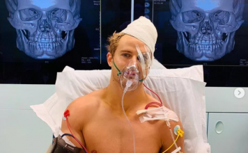 Unui fost luptător din UFC i-au fost scoase 30 de bucăți de os din față după ce și-a luat KO! (VIDEO) Unui fost luptător din UFC i-au fost scoase 30 de bucăți de os din față după ce și-a luat KO! (VIDEO)